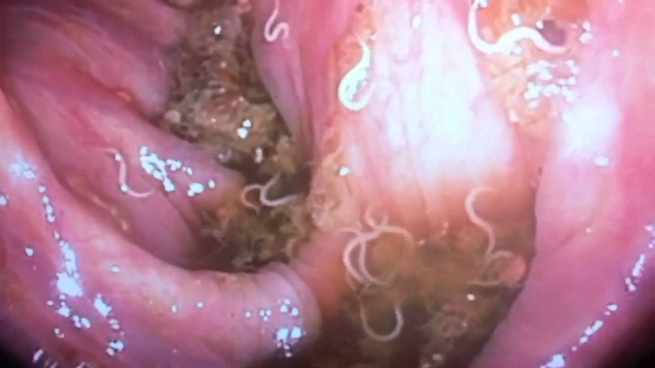 Inside Of Vagina Coming Out 83