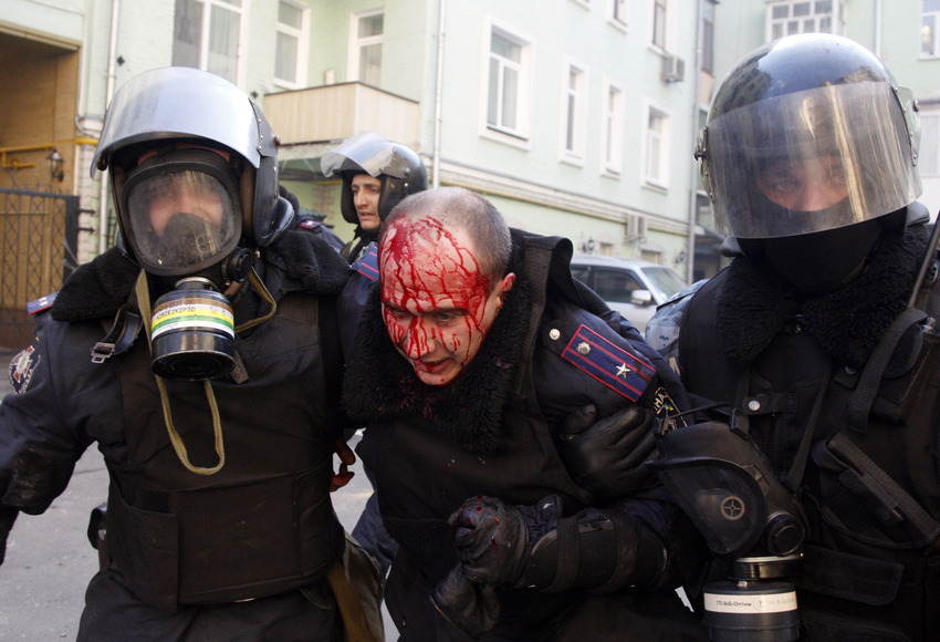 Ukraine Uprising Bloody Head