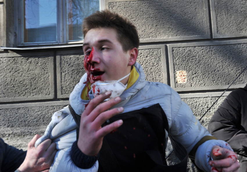 Ukraine Uprising Wounds